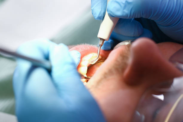 Best Emergency Tooth Extraction  in Blue Earth, MN