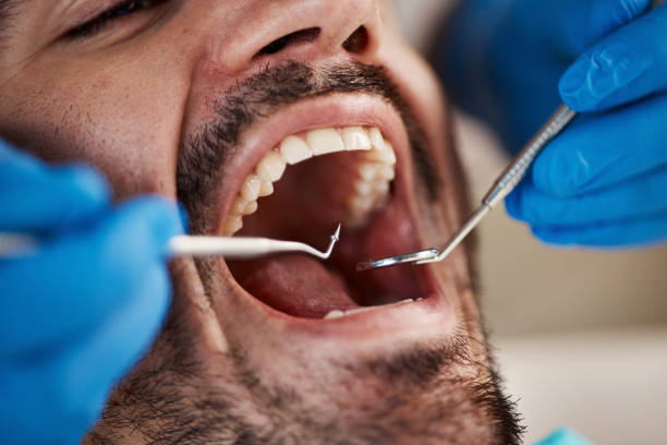 Best Chipped Tooth Repair Near Me  in Blue Earth, MN